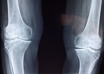 Shibarium Network Lull – How It Affects The Future Of BONE