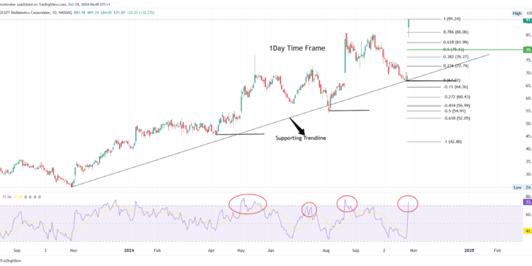Top Stock Gainers & Losers: PRCT Stock +32%, PHG -16% Drop
